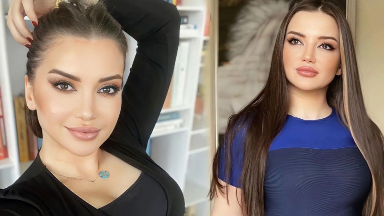 Psikolog Esra Ezmeci'nin estetiksiz halini gören tanıyamadı! İşte sosyal medyaya sızan o estetiksiz fotoğraf