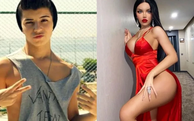 Cinsiyet değiştirmişti! Beren Güney tüm estetiklerini geri aldırdı, son hali görenleri şok edecek